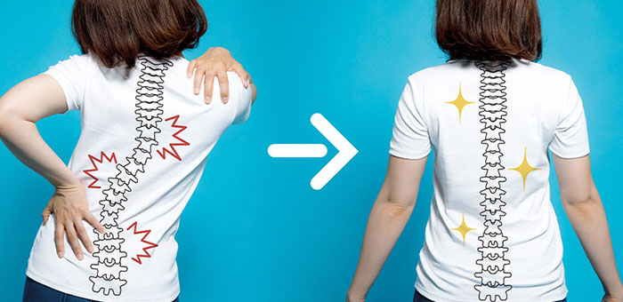 chiropractic for good posture in Marlton NJ