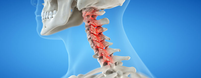 patient needing bone spur treatment in Marlton