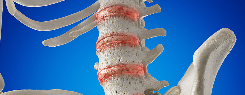patient needing degenerative disc disease treatment in Marlton