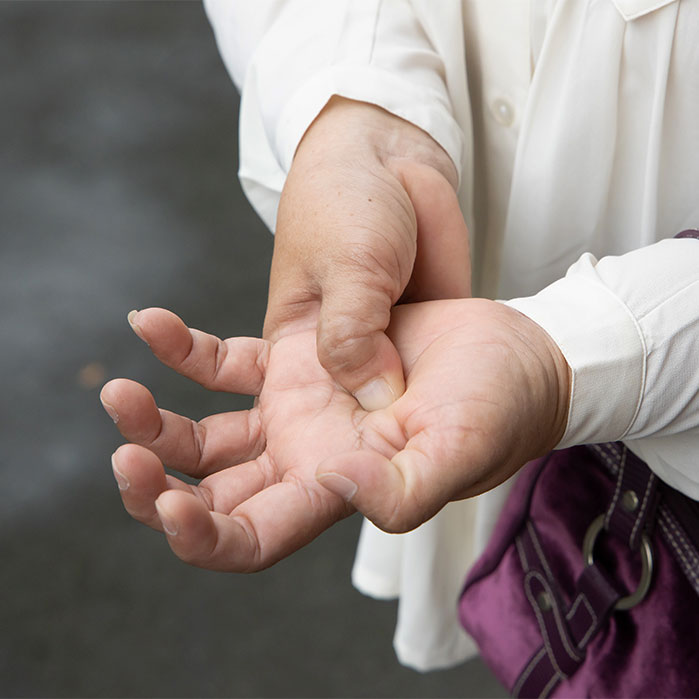 dupuytren contracture chiropractor in Marlton NJ