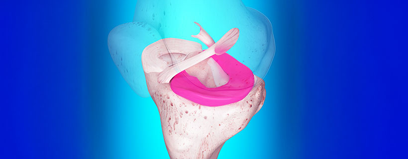 patient needing ligamentitis treatment in Marlton