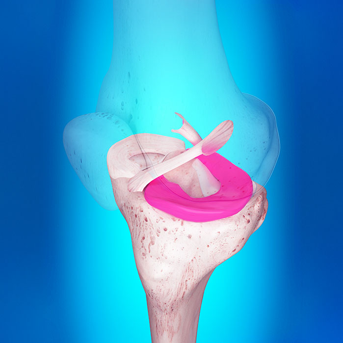 ligamentitis chiropractor in Marlton NJ