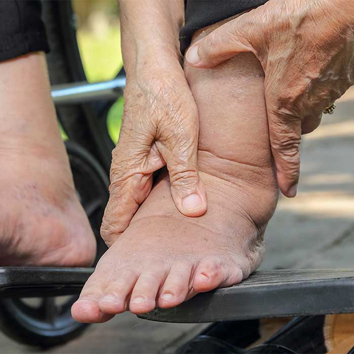 peripheral neuropathy relief in Marlton NJ