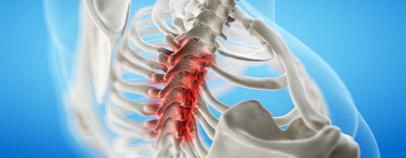 patient needing spinal stenosis treatment in Marlton