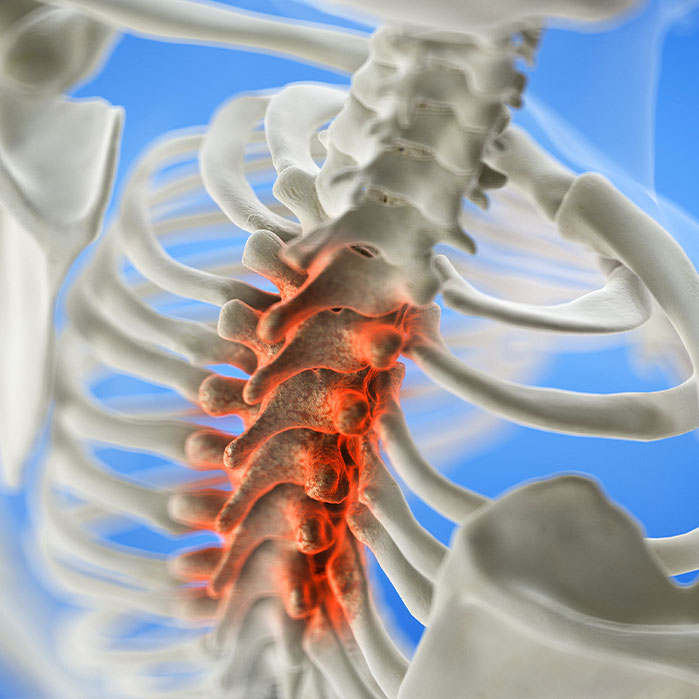 spinal stenosis treatment in Marlton NJ